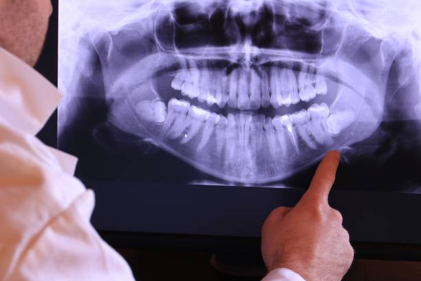 Best Emergency Treatment for Dental Infections or Abscesses in St Michael, MN