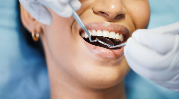 Best Urgent Care for Lost Fillings or Crowns in St Michael, MN